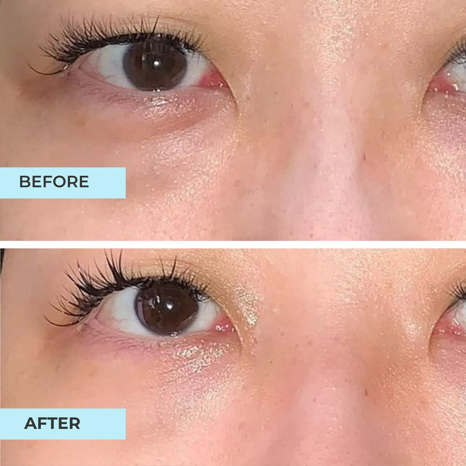 Dark Circle Advanced Oligopeptide Complex Serum