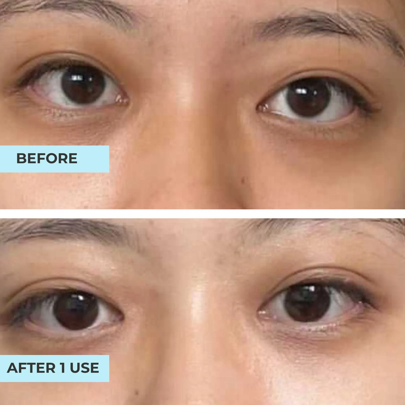 Dark Circle Advanced Oligopeptide Complex Serum
